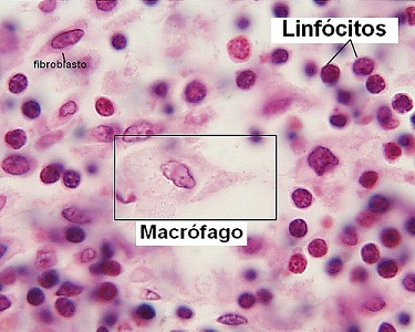 Imagem de Microscópio de luz, componentes celulares do Tecido Conjuntivo Matriz Extracelular 