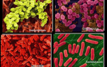 Bactérias – Morfologia e Características, Gram Positiva e Negativa