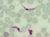 Doença de Chagas: Ciclo de Vida, Patologia e Quadro Clínico