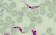 Doença de Chagas: Ciclo de Vida, Patologia e Quadro Clínico