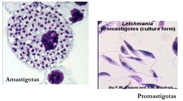 Patologia: Formas das Leishmanias